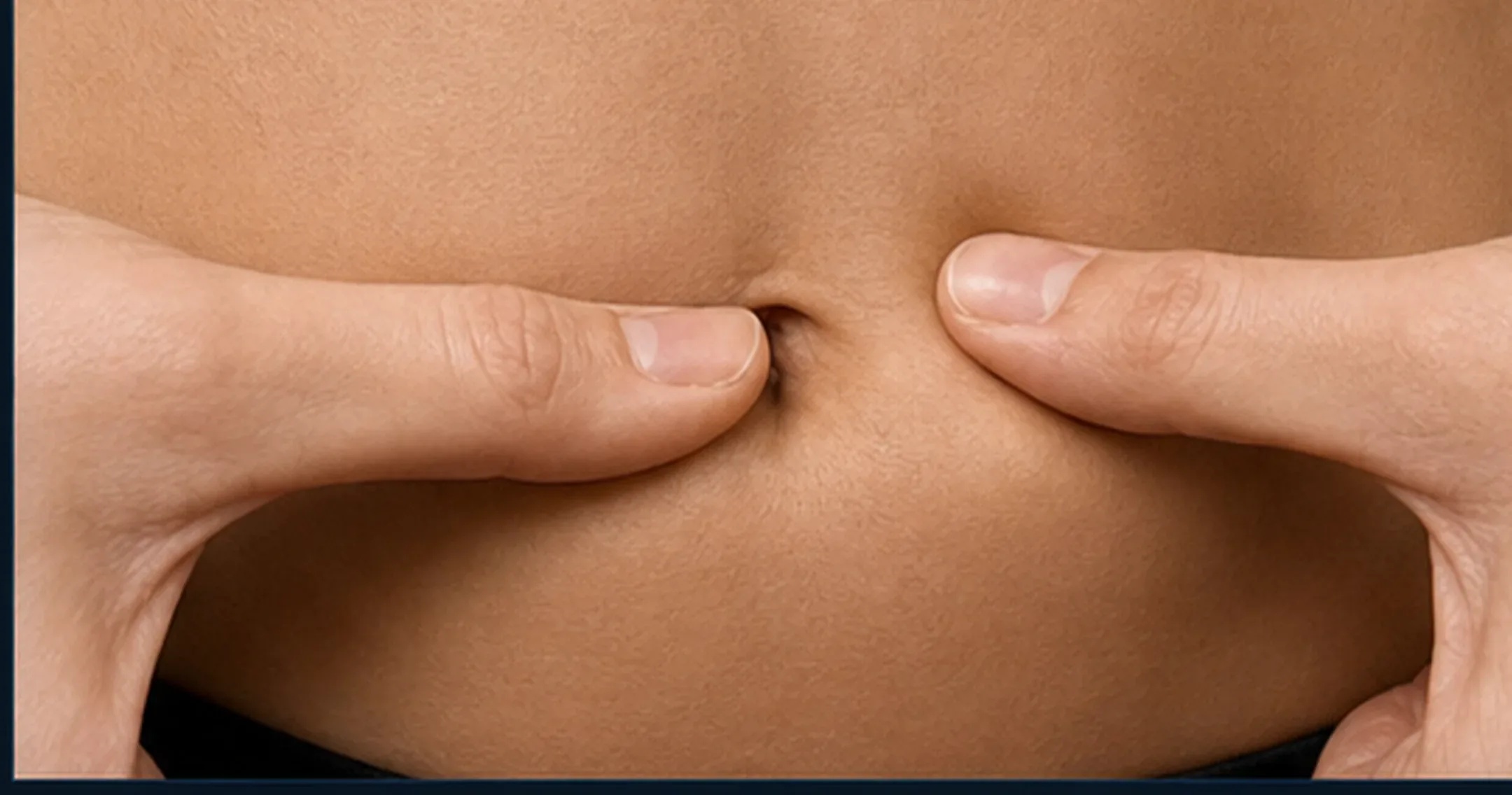 Dedos formando un pliegue de piel en abdomen para técnica subcutánea